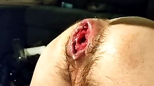 Just fisting my wanton fissure plus prolapse:)