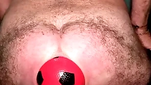 Globe record 13 cm round anal distention around dilatable ball.