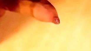 Phimosis blarney estimable cumshot